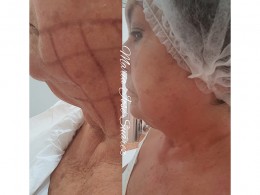 Verde Limón - Santa Cruz