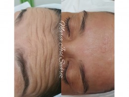 Verde Limón - Santa Cruz