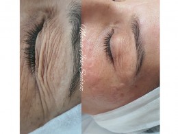 Verde Limón - Santa Cruz