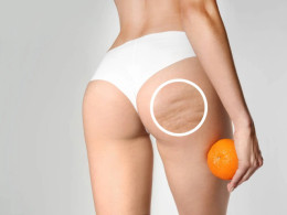 MiSPA Centro E.I.S - Las Palmas