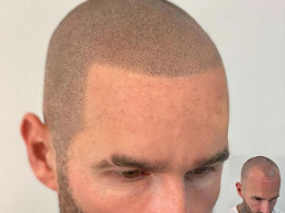 Aurisnely Villanueva - La Laguna