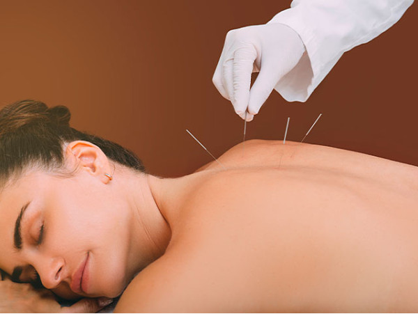 Acupuntura Atono - Santa Cruz de Tenerife 