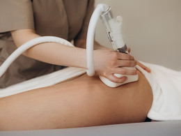 Blanqueamiento dental con técnica innovadora ¡Luce una sonrisa radiante!